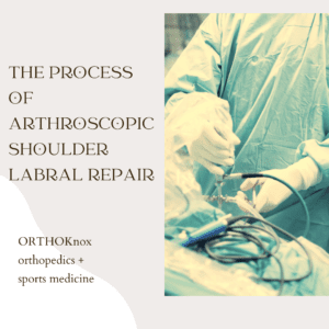 close up of arthroscopic labral repair