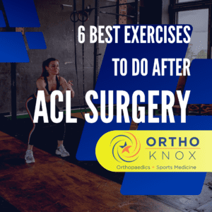 6 Best Exercises to Do After ACL Reconstruction Surgery
